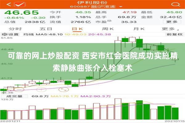 可靠的网上炒股配资 西安市红会医院成功实施精索静脉曲张介入栓塞术